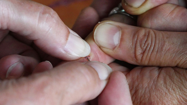 Close-up van een splinter in een vinger